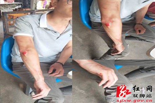 扶贫路上:轻伤不下火线 森林土鸡暖民心